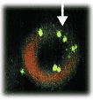 Bartonella Quintana
