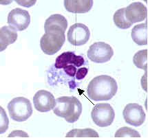 Erlichiosis