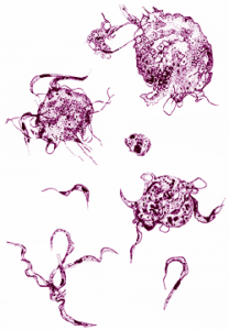 Trypanosomiasis – Sleeping Sickness